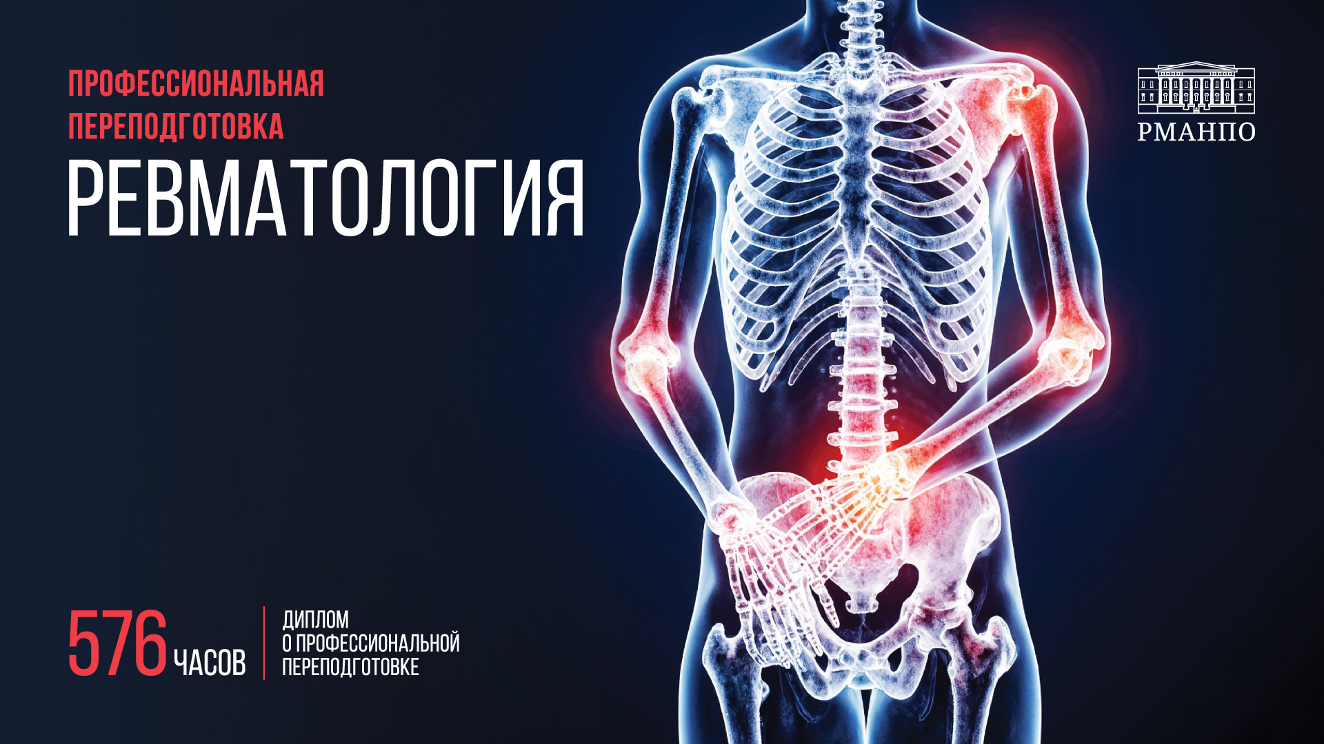 Ревматология