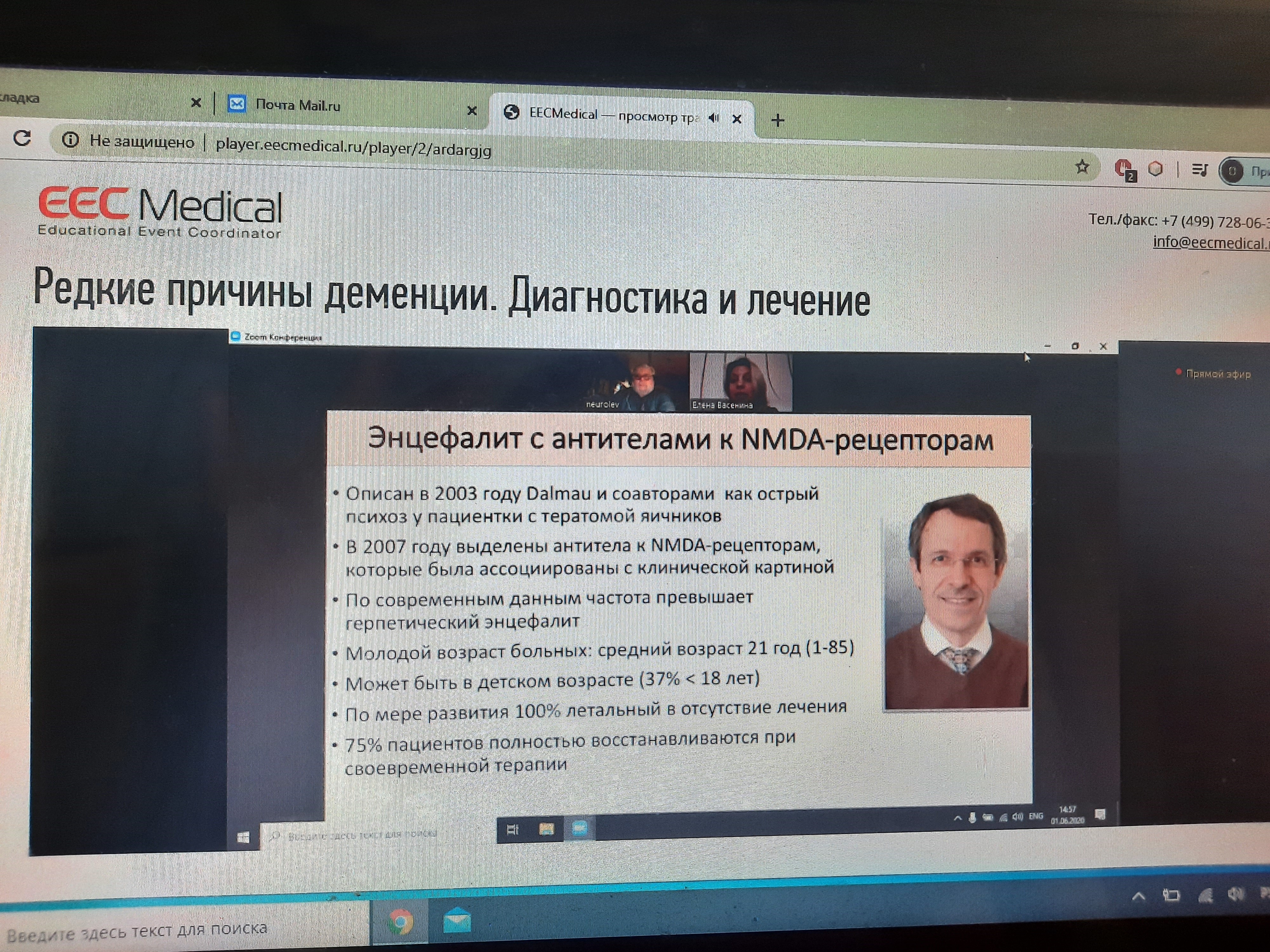 В РМАНПО прошла онлайн-конференция «Редкие причины деменции: диагностика и лечение»