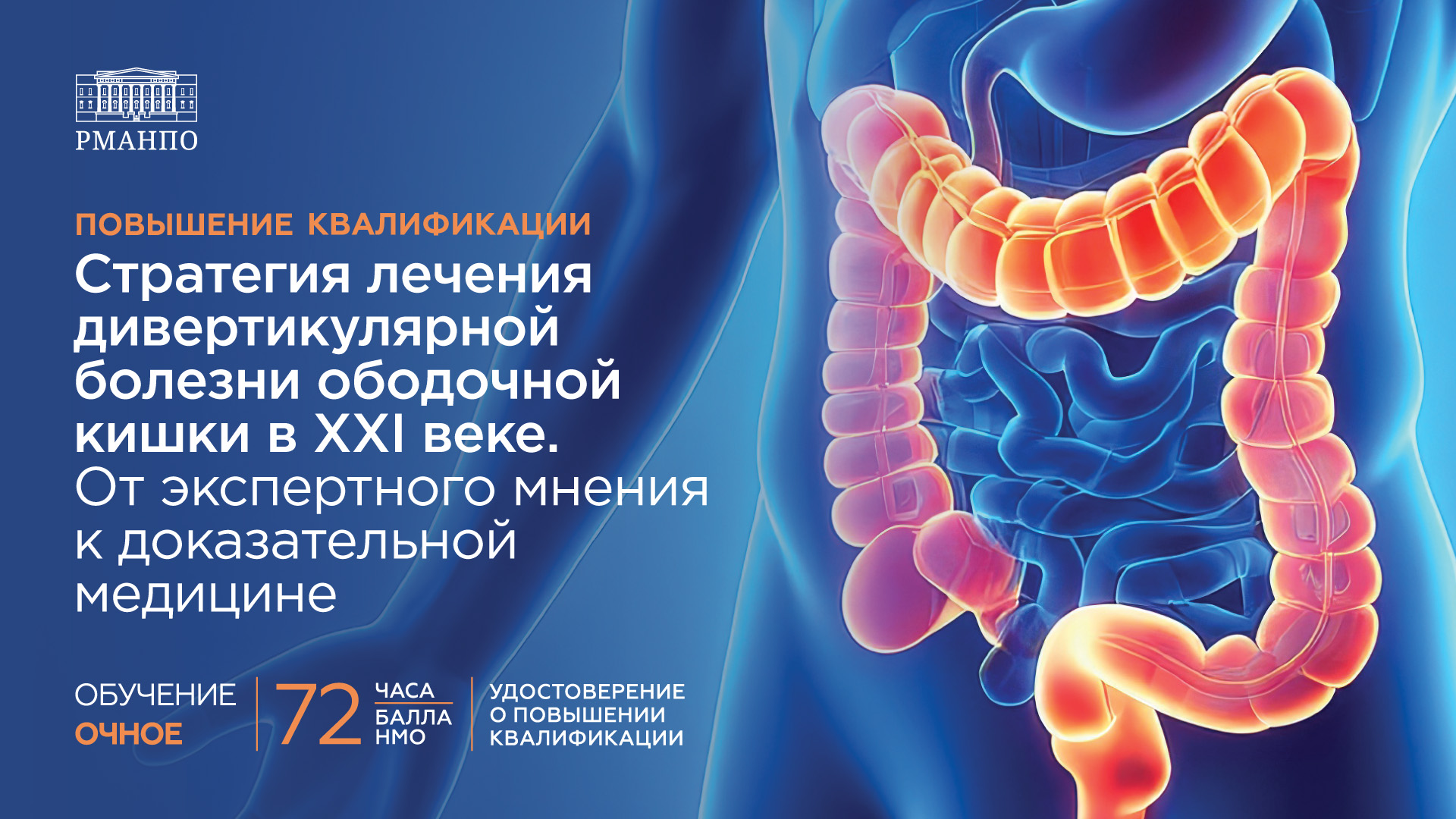 Стратегия лечения дивертикулярной болезни ободочной кишки в XXI веке. От экспертного мнения к доказательной медицине