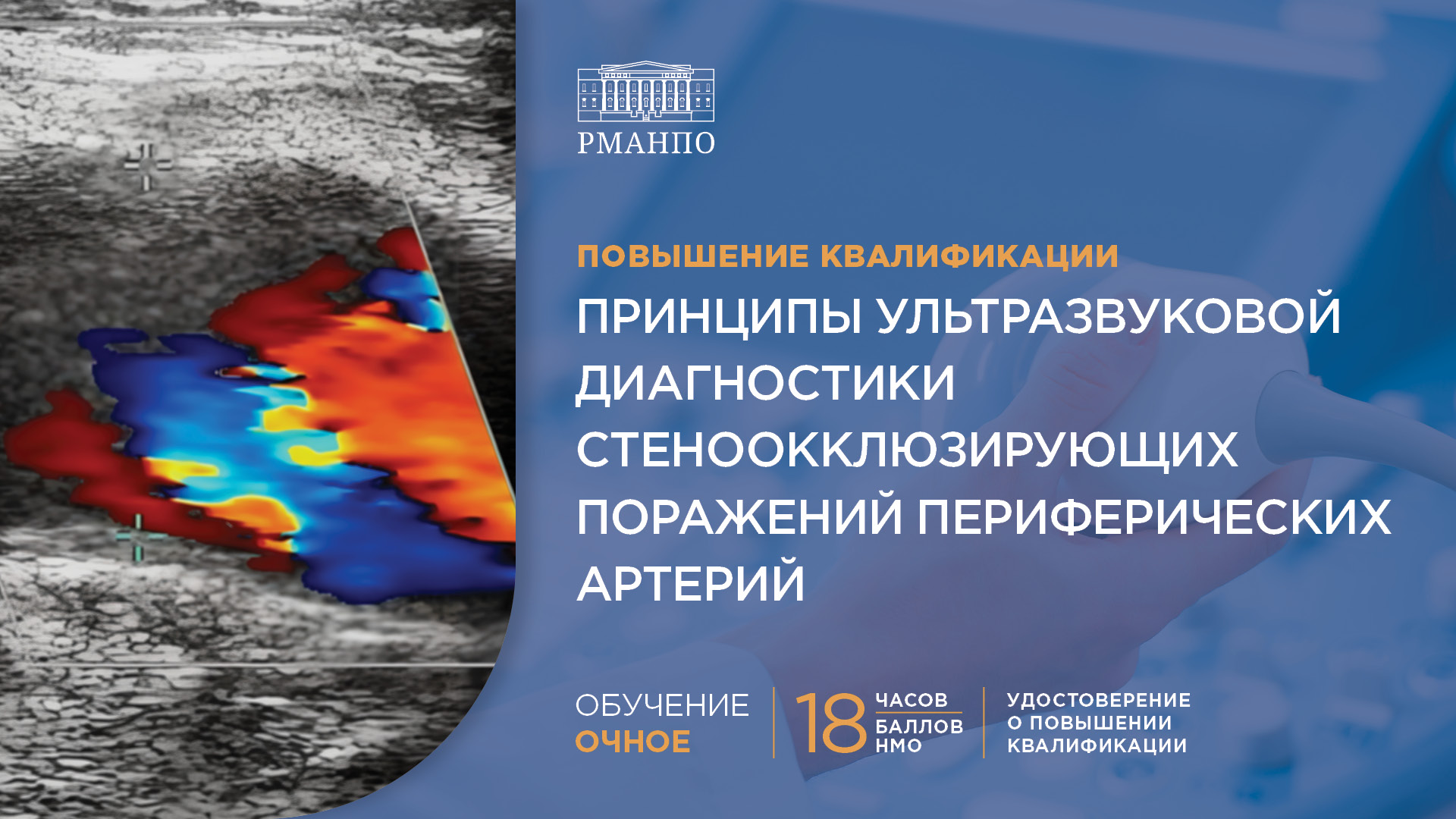 Принципы ультразвуковой диагностики стеноокклюзирующих поражений периферических артерий