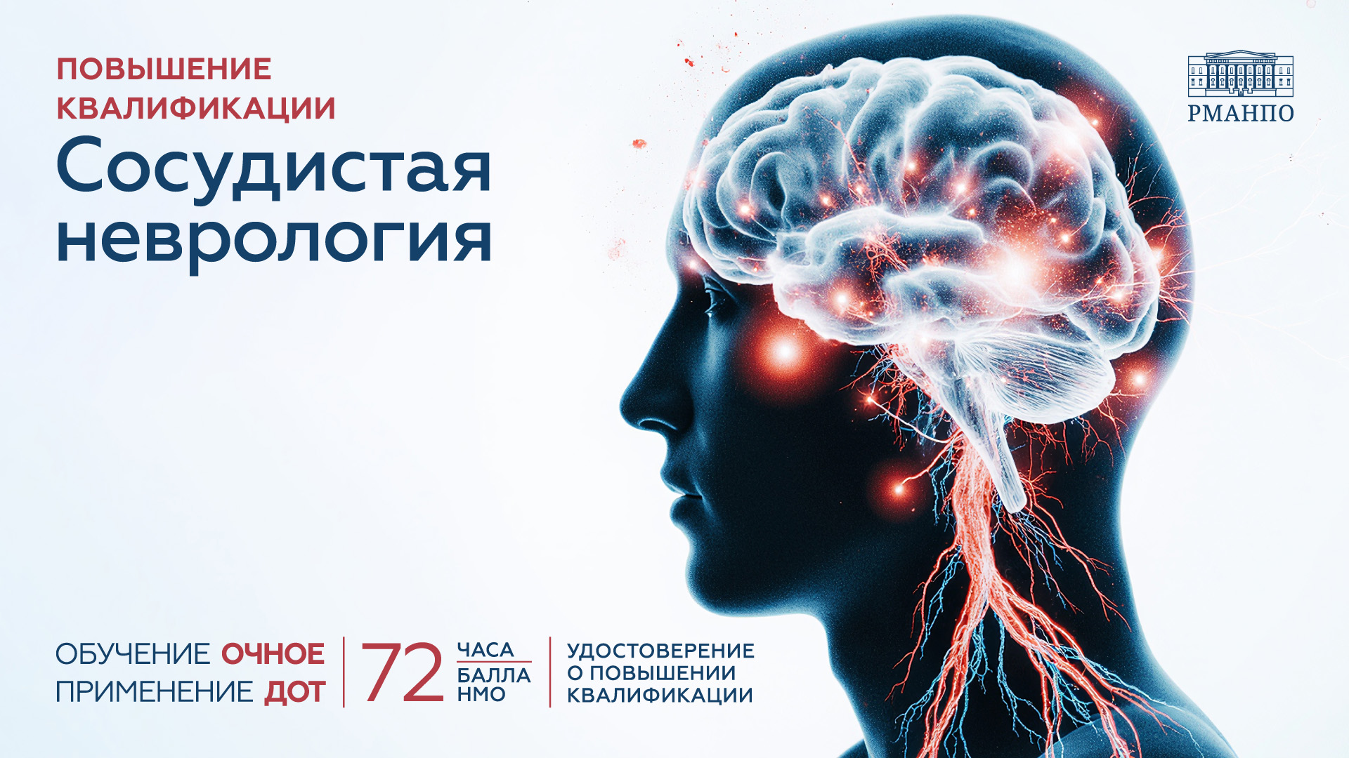 Сосудистая неврология